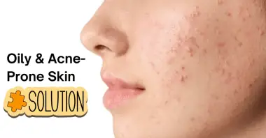 Complete Skin Care Guide for Acne, Oily Skin & Glow | Lorena Organics